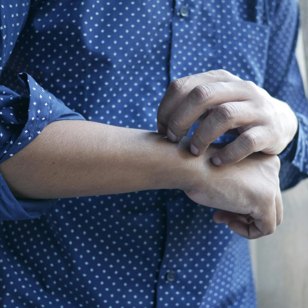 Can UTIs Cause Skin Itching?